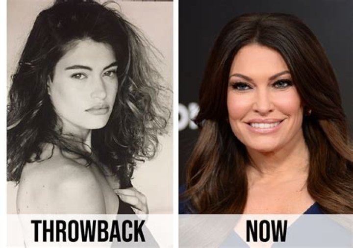 Transformative Journey: Kimberly Guilfoyle Before And After Surgery